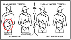Postural compensation patterns showing common imbalances